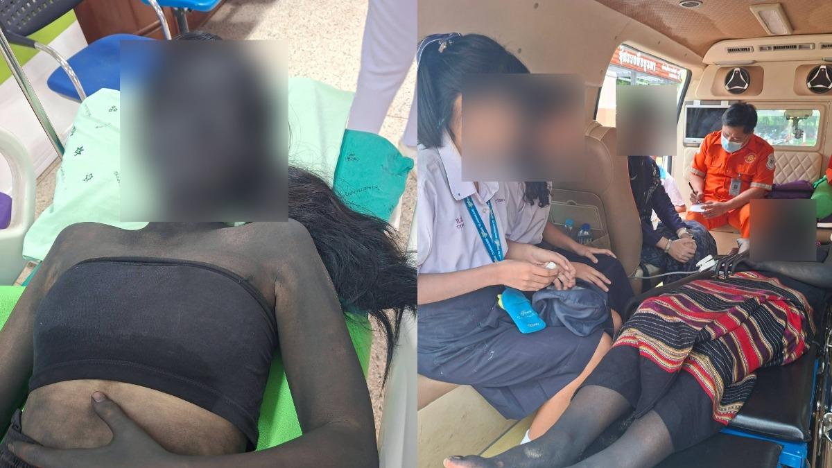 突腹痛送醫!泰少女「全身黑」現身 救護員嚇喊像接到鬼