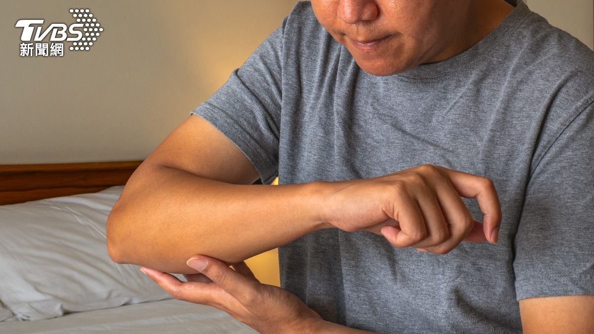 腰背腫塊長多年！55歲男怕癌化求診　醫揭4大常見皮膚瘤