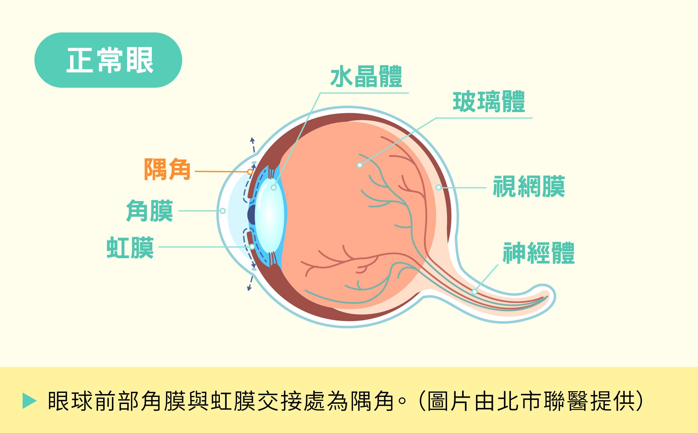 「白內障微創手術」能讓患者重獲清晰視力,眼房水排出的途徑順暢。(圖/北市聯醫提供)