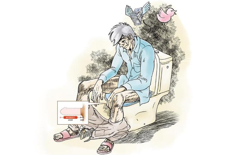 重振雄風手術失敗 二春男命根慘遭切除