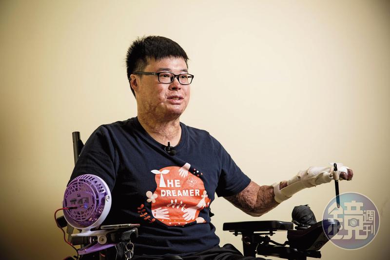 連葬儀社都找好了 截肢後5%存活率他要拚