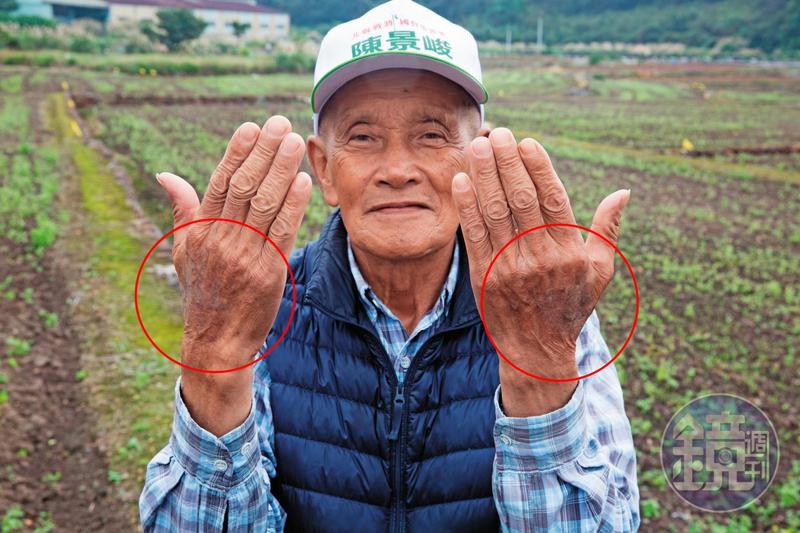 晚一步就致命！　一個里百人遭紅火蟻恐攻
