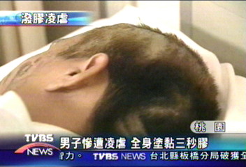 男子慘遭凌虐 全身塗黏三秒膠