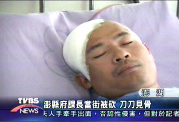 當街被砍4刀　兇嫌狠毒刀刀見骨