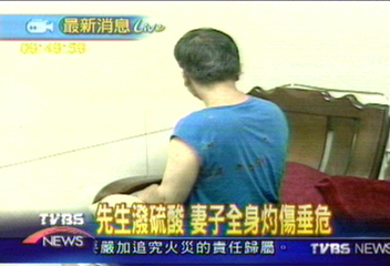 躁鬱症先生潑酸　太太毀容命危