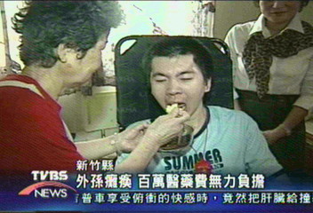 外孫癱瘓　百萬醫藥費無力負擔
