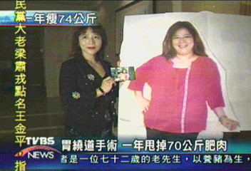 一年甩70公斤肥肉的「胃繞道手術」要去哪做?