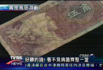 好髒的錢　看不見病菌齊聚一堂