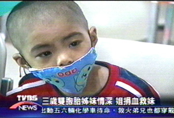 罹患重型海洋性貧血 兄捐血救妹