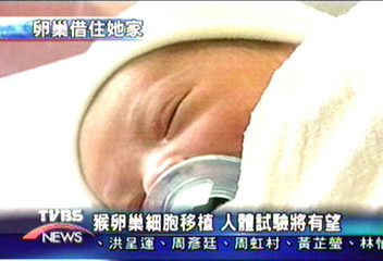 移植卵巢細胞　造福罹癌不孕婦女
