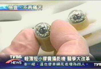 膠囊攝影機　內視鏡檢查不再痛苦