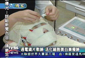 〈獨家〉通電鐵片敷臉 活化細胞美白兼瘦臉