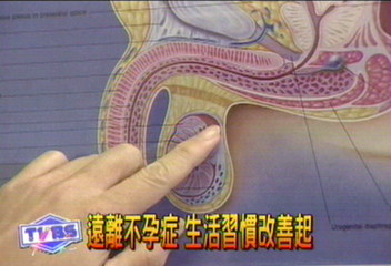 遠離不孕症　生活習慣改善起