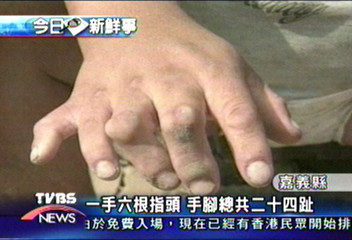 一手六根指頭 手腳總共二十四趾