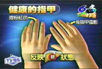 從指甲看氣血 微粉紅、帶弧影最健康