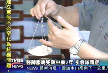吃馬兜鈴酸中藥 中醫師需洗腎