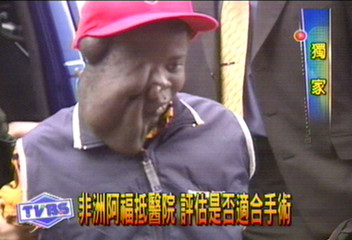 〈獨家〉非洲阿福抵醫院 評估是否適合手術