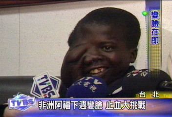 非洲阿福下週變臉 止血大挑戰