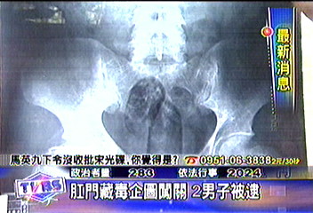 肛門藏毒企圖闖關 2男子被逮