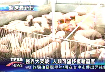 醫界大突破 人類可望移植豬器官