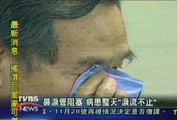 鼻淚管阻塞 病患整天「淚流不止」