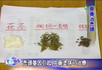 基因檢驗，中藥塗抹治療禿頭的醫院是？