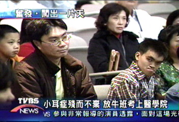 小耳症殘而不棄　放牛班考上醫學院