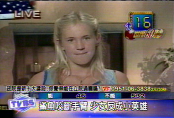 鯊魚咬斷手臂　少女勇敢面對人生