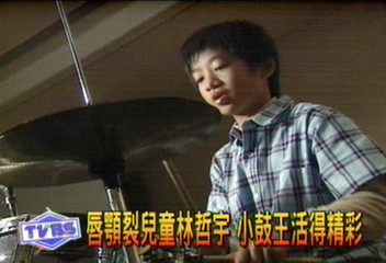 唇顎裂兒童林哲宇　小鼓王活得精彩