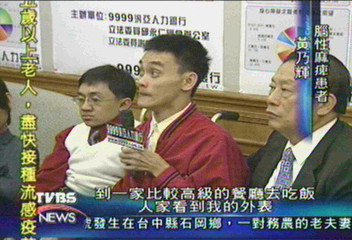 連體嬰忠仁就業難 籲企業勿以貌用人