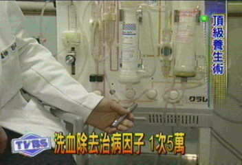 抗老減肥養生 有人靠洗血