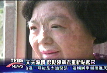 命運無情捉弄　災民陳幸君無懼面對