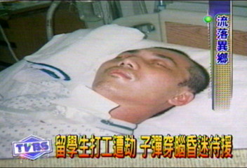 留學生打工遭劫 子彈穿腦昏迷待援