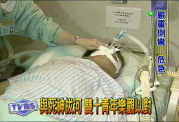罕見病例!青年脊椎側彎百度