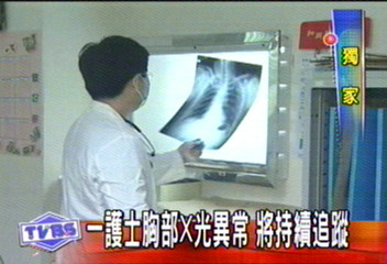 〈獨家〉和醫2護士疑染肺結核 休假觀察