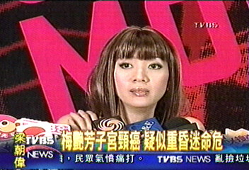 子宮頸癌化療　梅豔芳傳病危