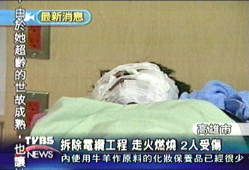 拆除電纜工程 走火燃燒 2人受傷