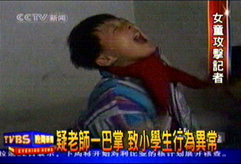 疑老師一巴掌 致小學生行為異常