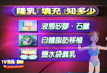 隆乳填充知多少 植入鹽水袋最安全