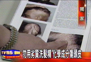 三千煩惱絲 掉髮原因外力多