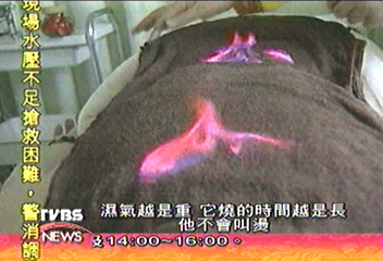 花錢引火焚身　藏火龍美容新招
