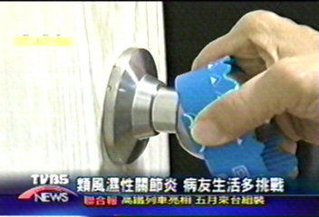 類風濕性關節炎　病友生活多挑戰