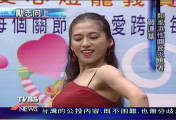 忍痛　風濕關節炎舞者克服病魔