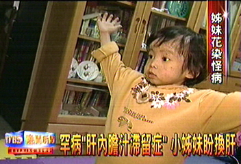 罕病「肝內膽汁滯留症」　小姊妹盼換肝