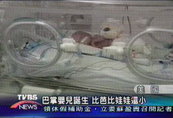 巴掌嬰兒誕生　比芭比娃娃還小