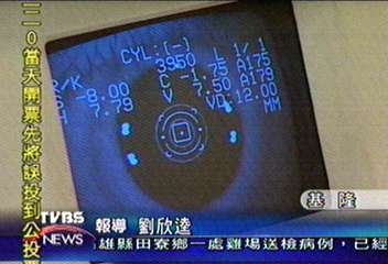 高空彈跳驚魂 6旬老翁眼睛脫窗