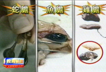 吃膽排毒? 膽汁中「膽醇鹽」反致中毒