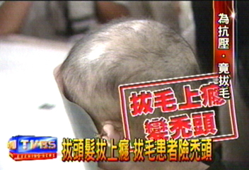 妙齡女郎壓力大 拔頭髮吃下肚