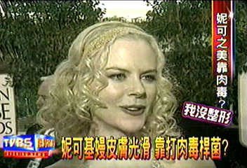 妮可基嫚皮膚光滑 靠打肉毒桿菌?