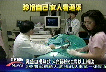 乳癌自摸無效 X光篩檢50歲以上補助